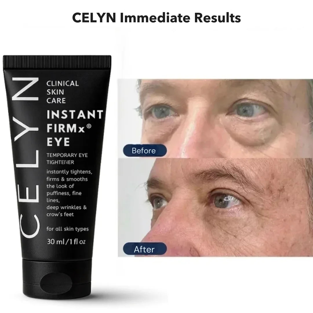 Instant Firmex Eye Tightener