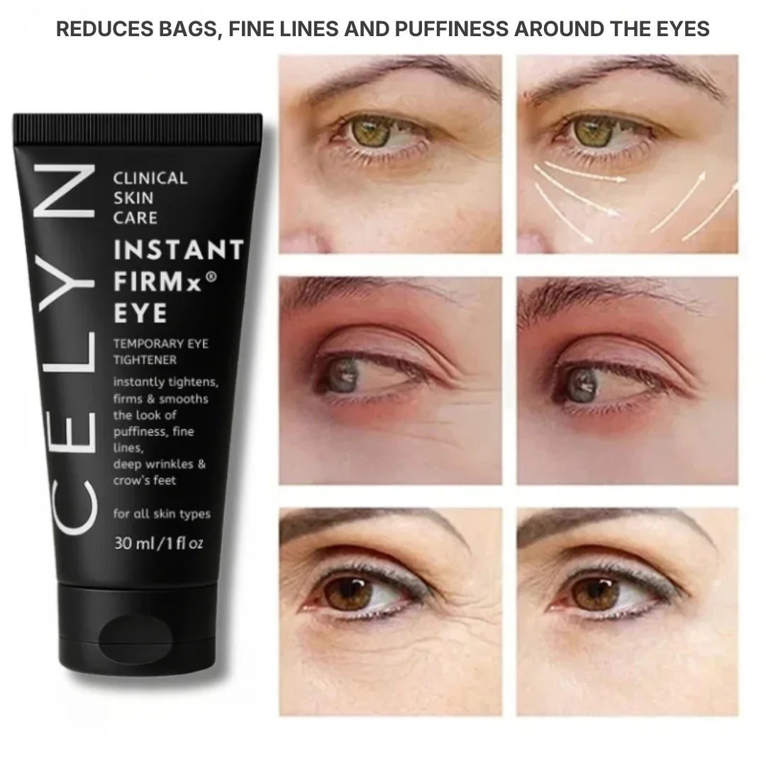 Instant Firmex Eye Tightener