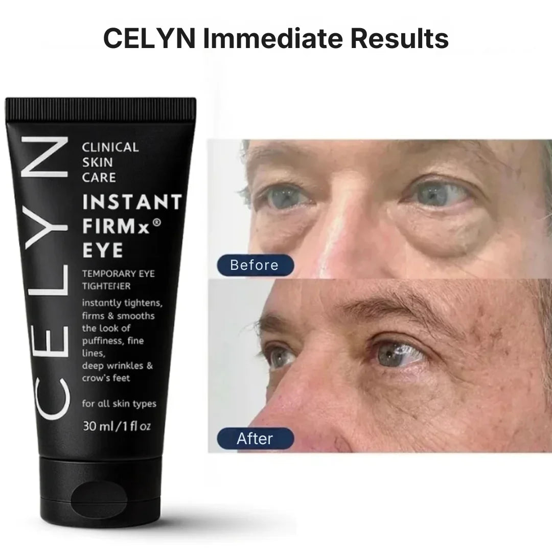 Instant Firmex Eye Tightener