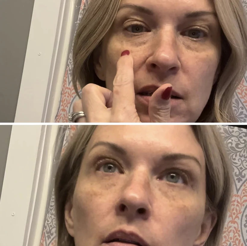 Instant Firmex Eye Tightener