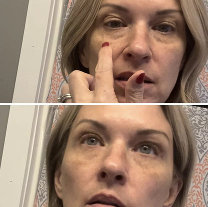 Instant Firmex Eye Tightener