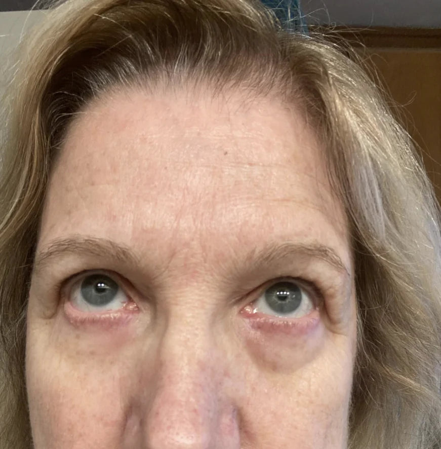 Instant Firmex Eye Tightener