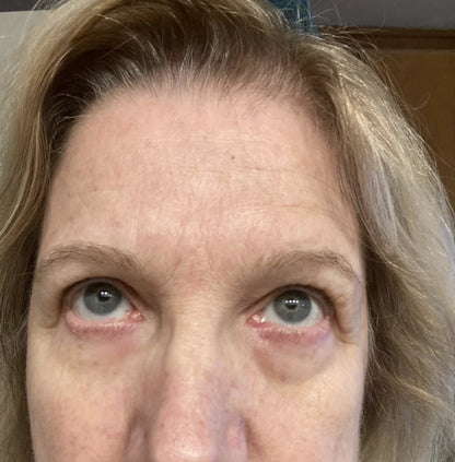 Instant Firmex Eye Tightener